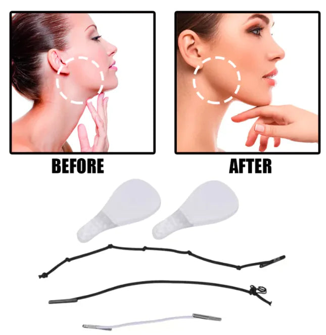 Lift & Tighten Tape Refill Set