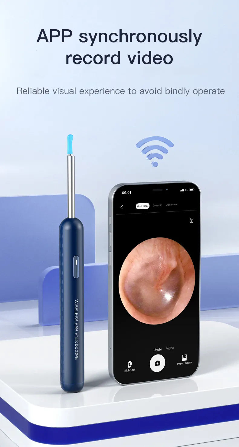 Visual Earpick Endoscope Device